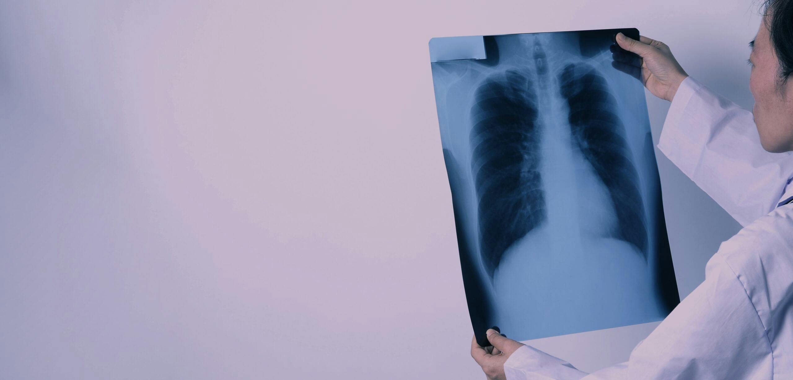 Middle aged of asian woman doctor standing and holding a x-ray f