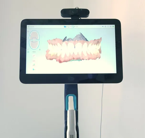 Intraoral scanner for digital impressions.
