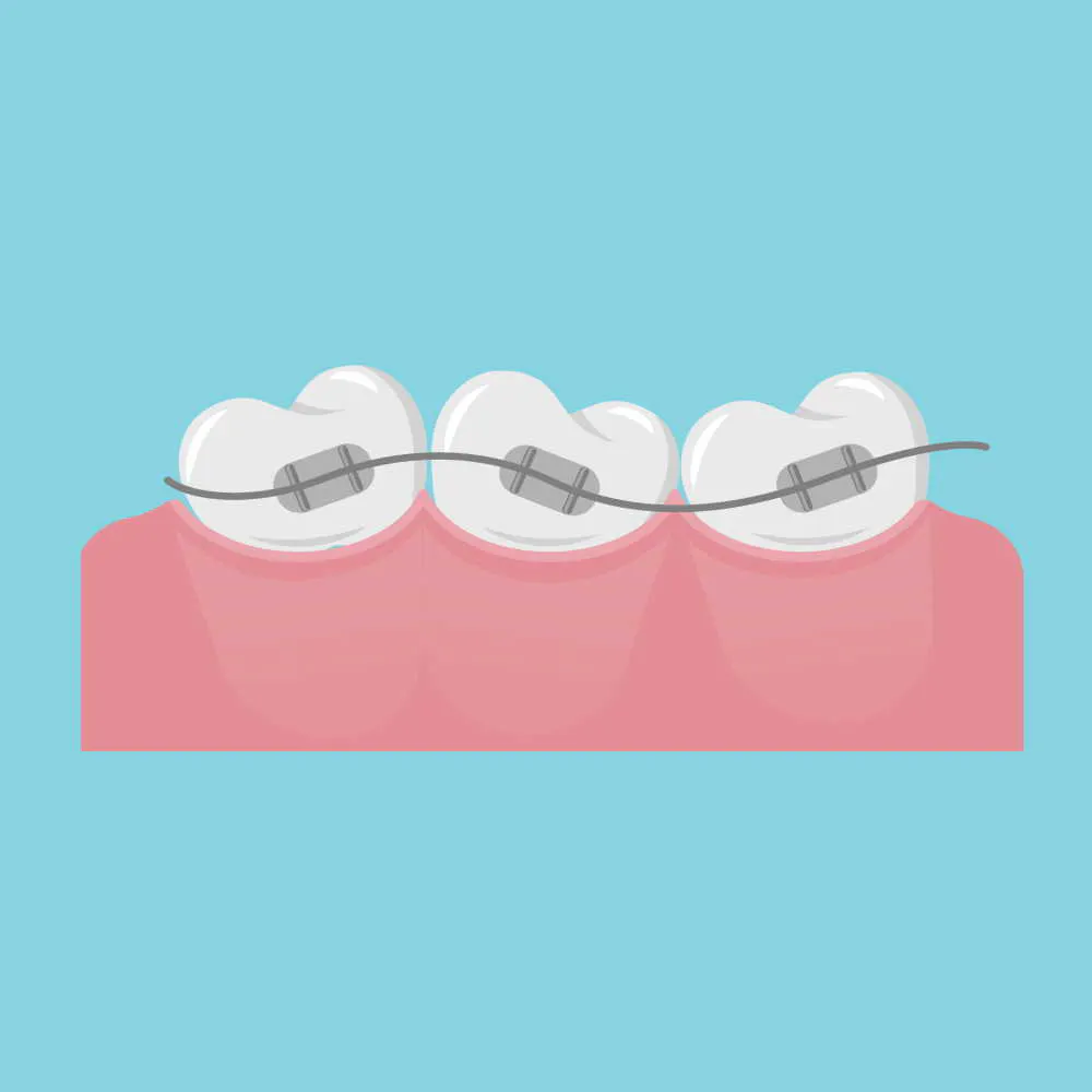 Orthodontic planning with models and images.