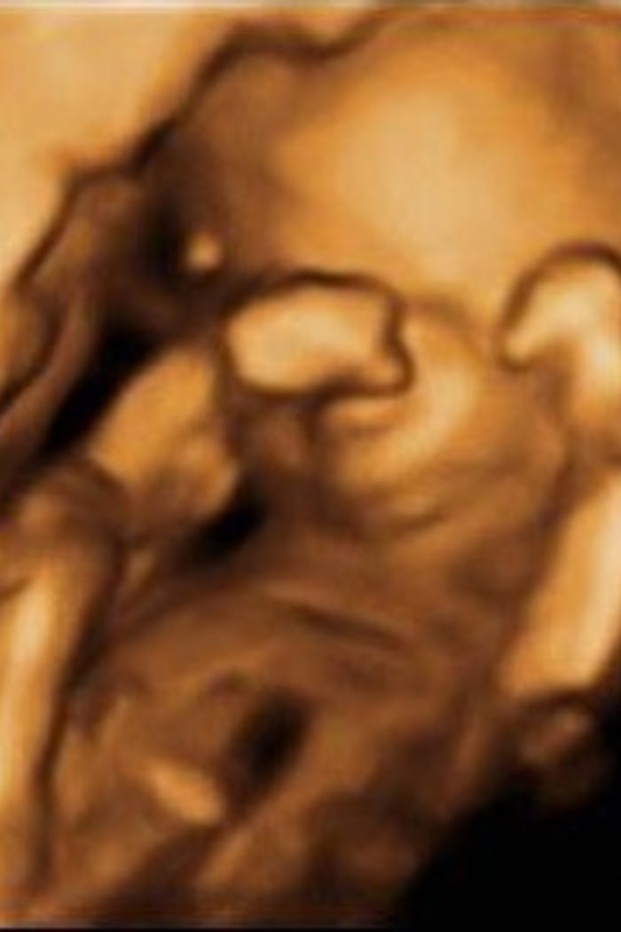 4D ultrasound of 16 week old baby girl