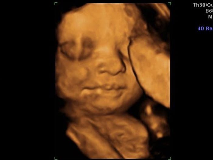 4D ultrasound of 30 week old baby girl