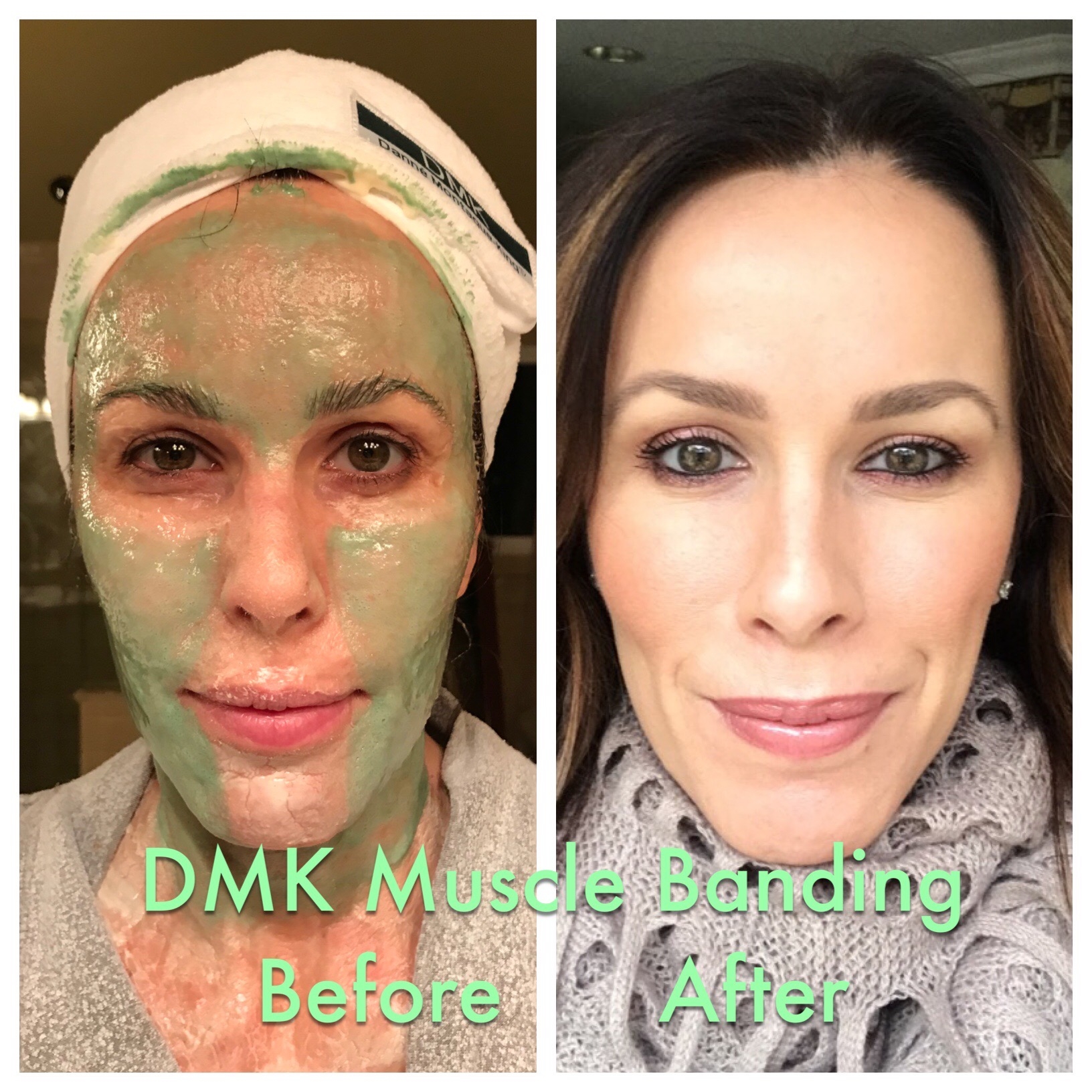 Enzyme facial before and after photo