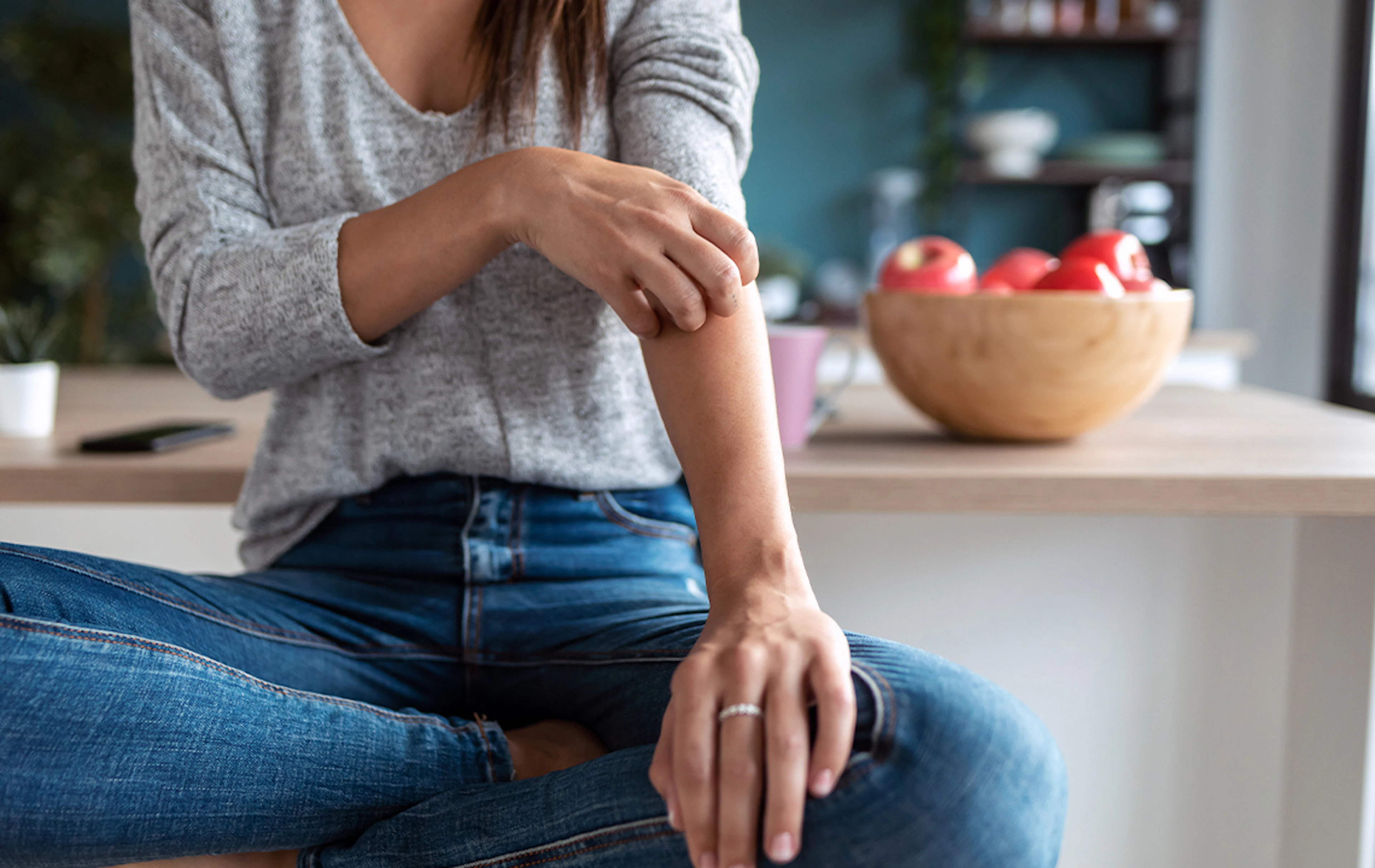 Psoriasis Guide