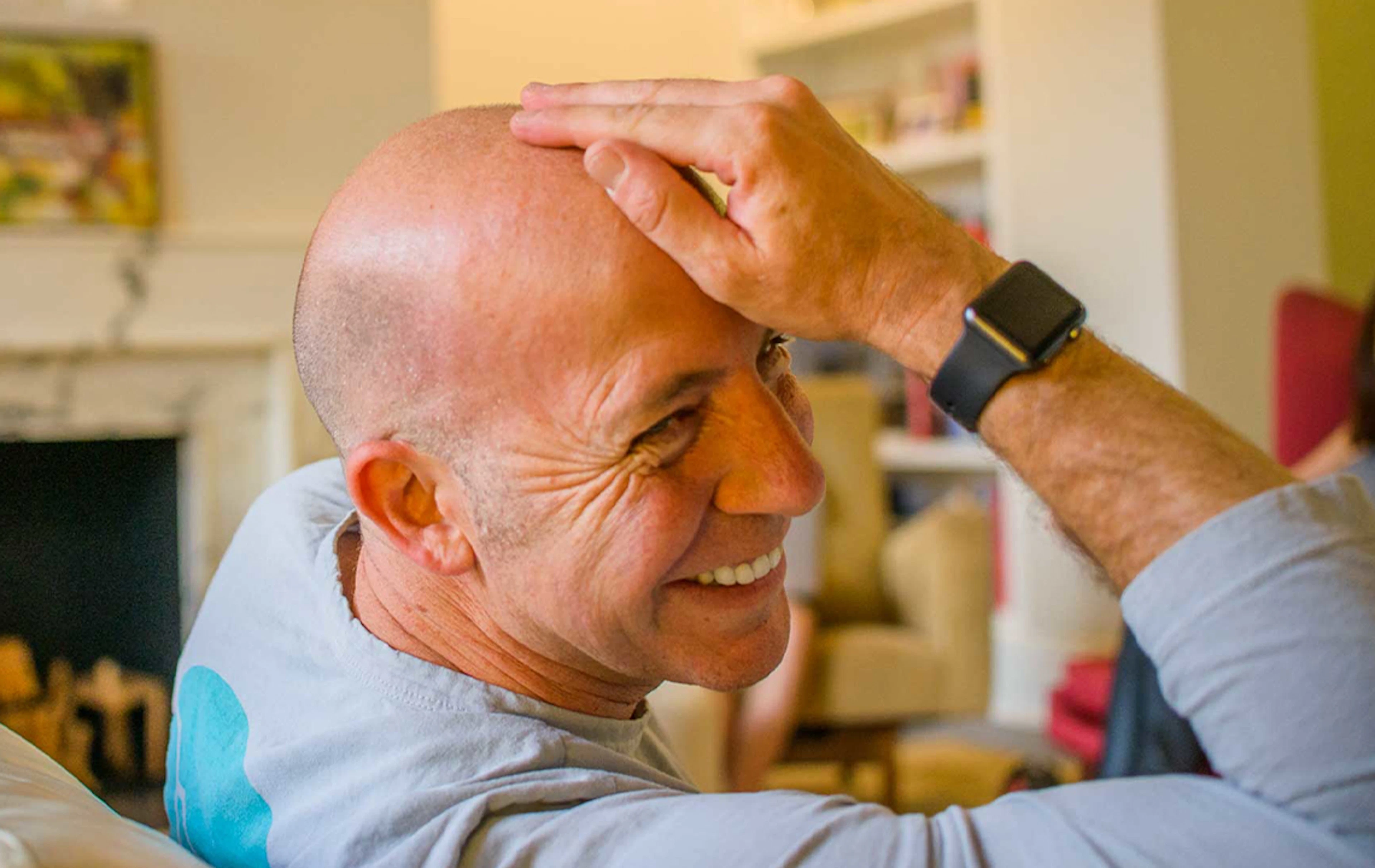 Man and Balding: the saga