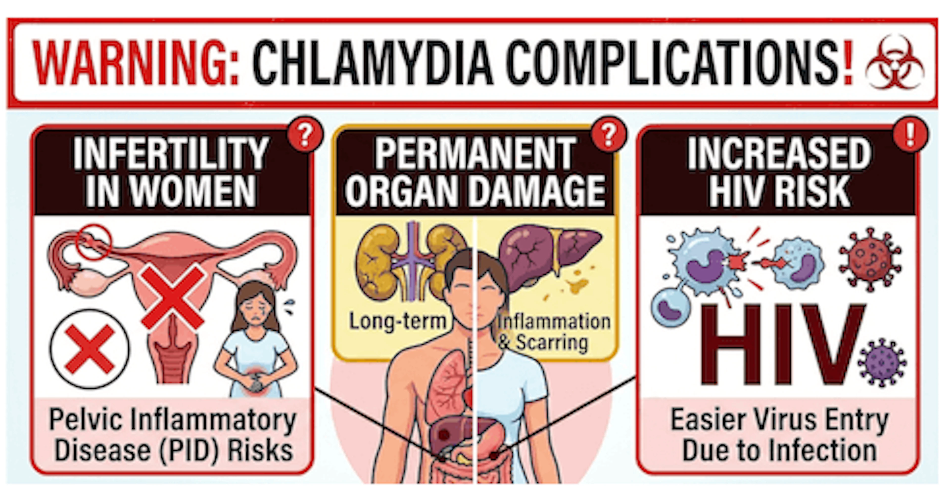 Chlamydia Complications
