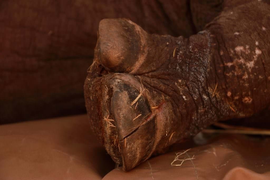 Damage to Arthur's foot