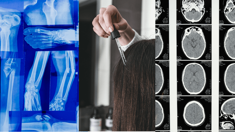A visual collage featuring a person's hand alongside an X-ray image and a pipette dispensing a hair serum.