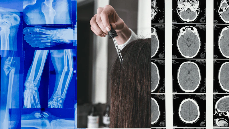 A visual collage featuring a person's hand alongside an X-ray image and a pipette dispensing a hair serum.