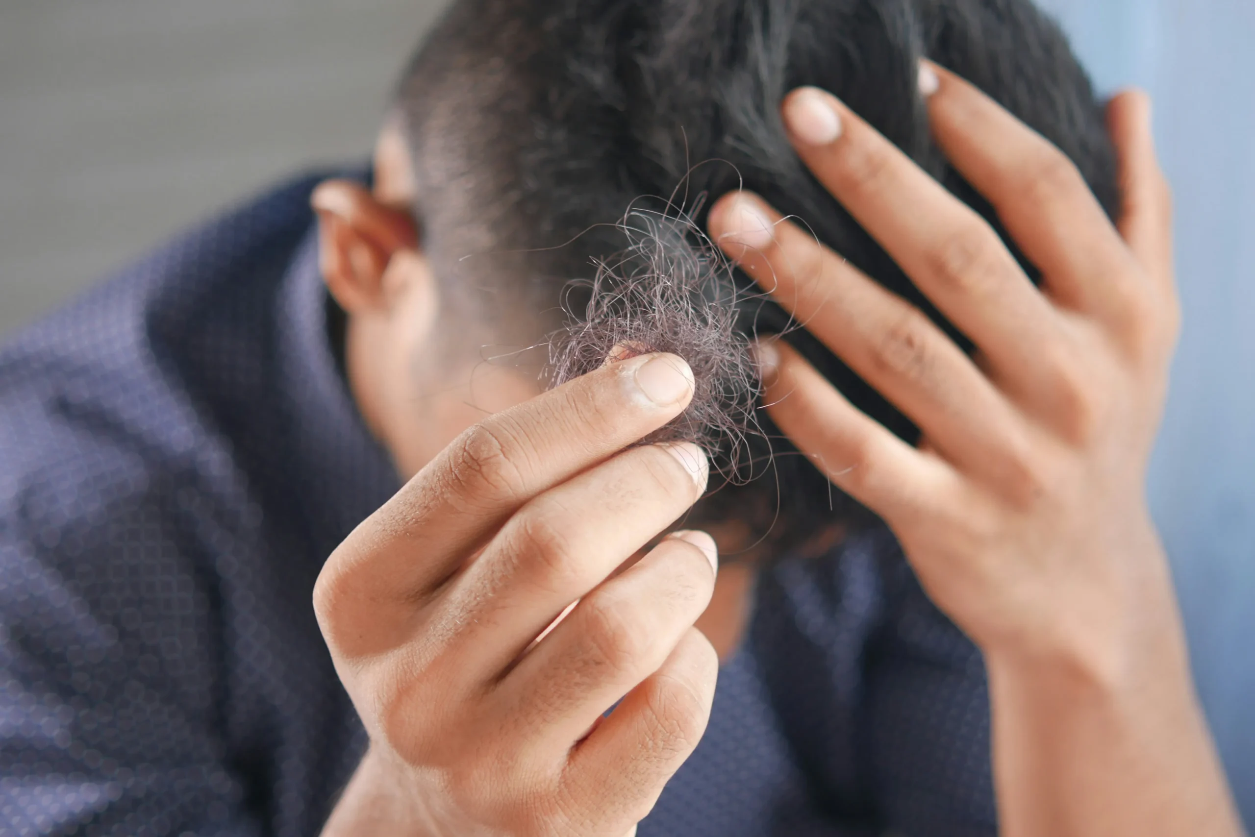A man holding a clump of hair.