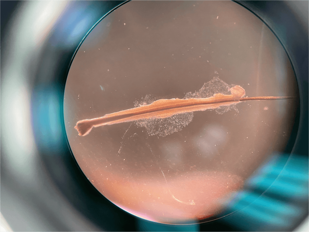 A microscopic image of a hair follicle bulb.