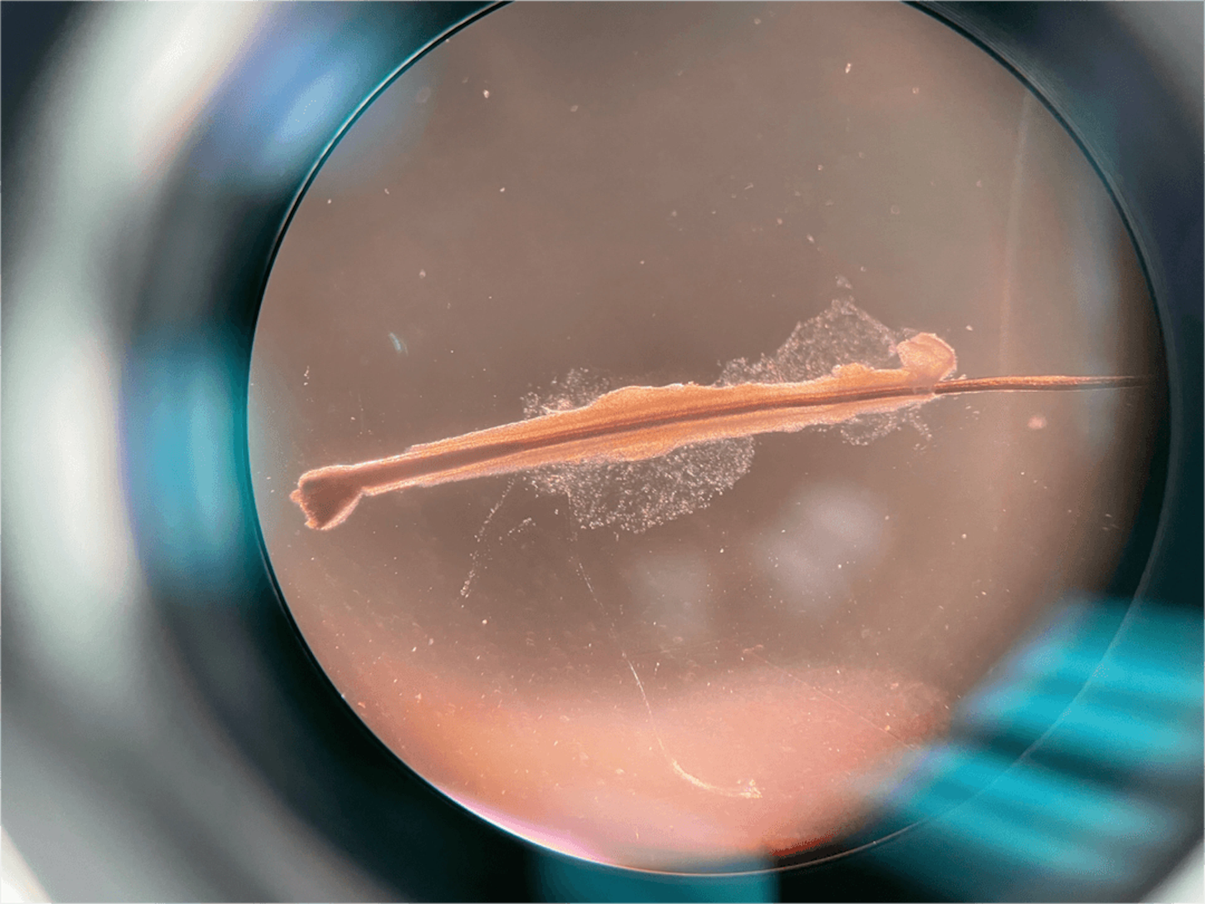 A microscopic image of a hair follicle bulb.
