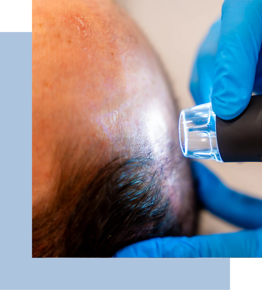 A doctor examines a man's head, focusing on his scalp and forehead during a medical consultation.