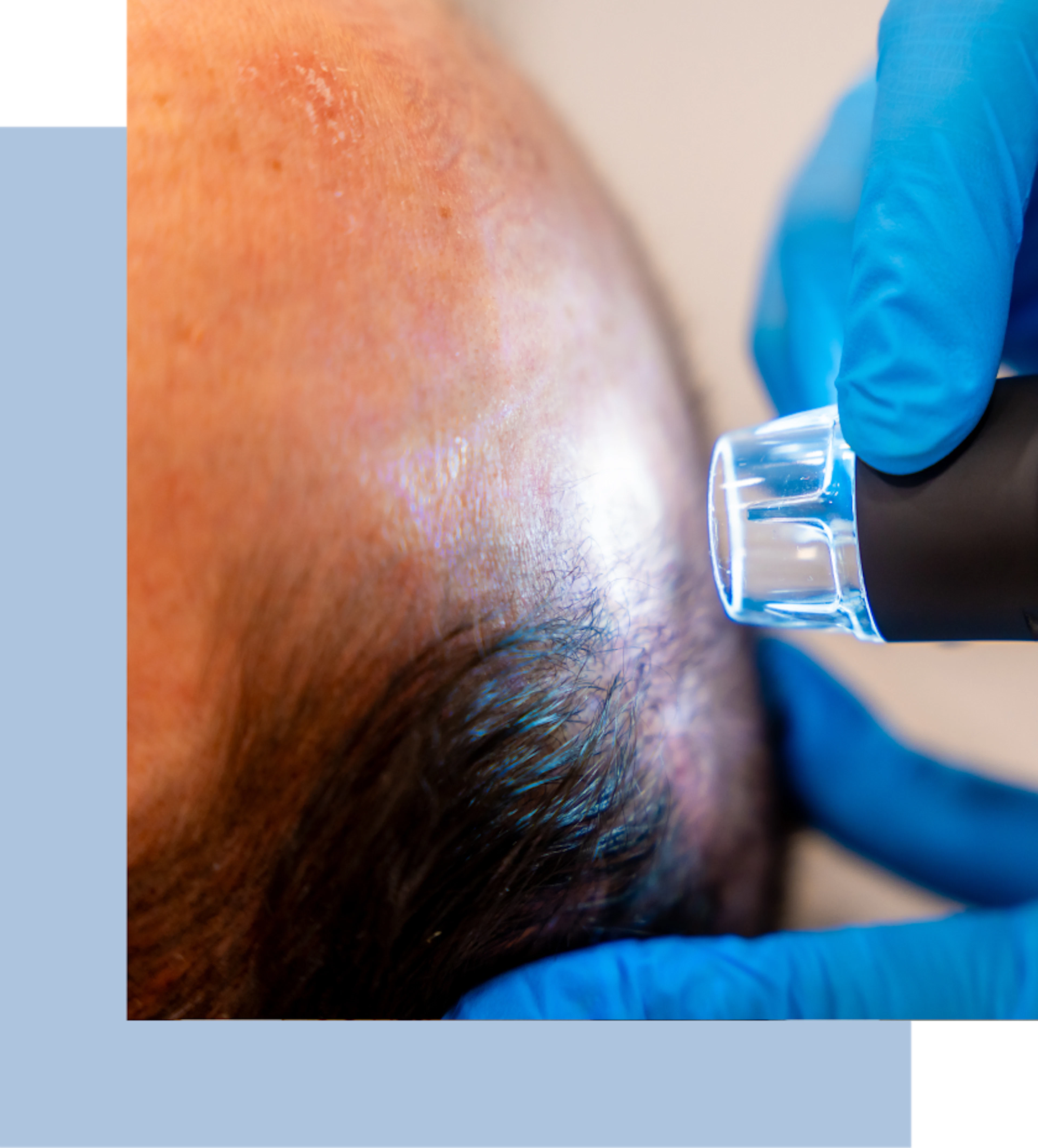 A doctor examines a man's head, focusing on his scalp and forehead during a medical consultation.