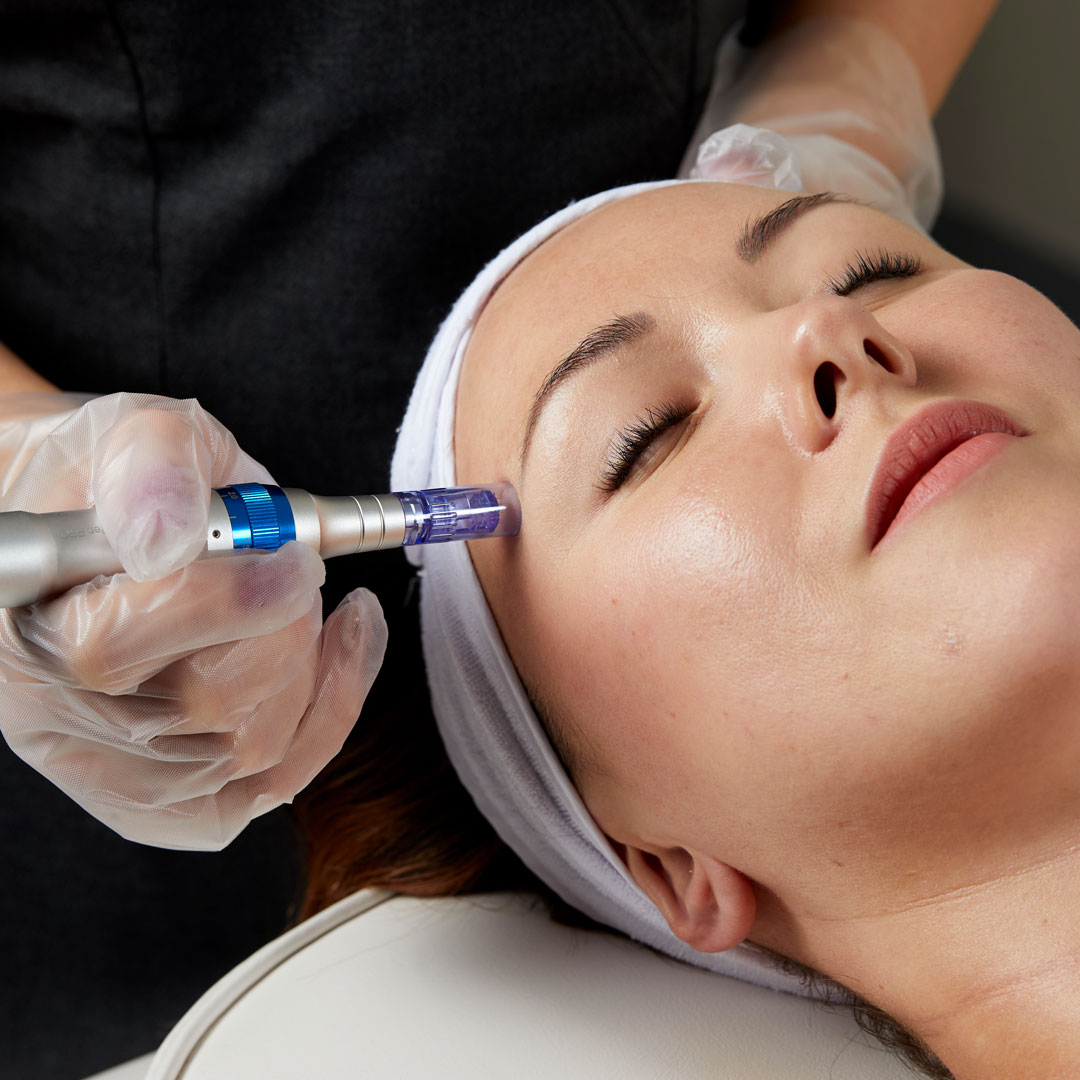 DERMAL PEN PRO MICRO-NEEDLING