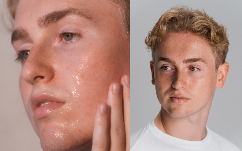 NEW clear start breakout clearing liquid peel