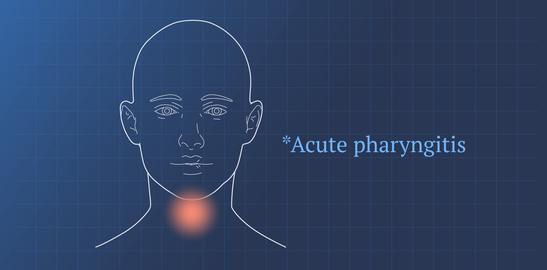 Cobblestone Throat (Acute Pharyngitis) Sign & Treatment | Ada