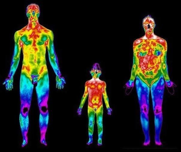 Termografia aposentadoria por fibromialgia - Advocacia Alves