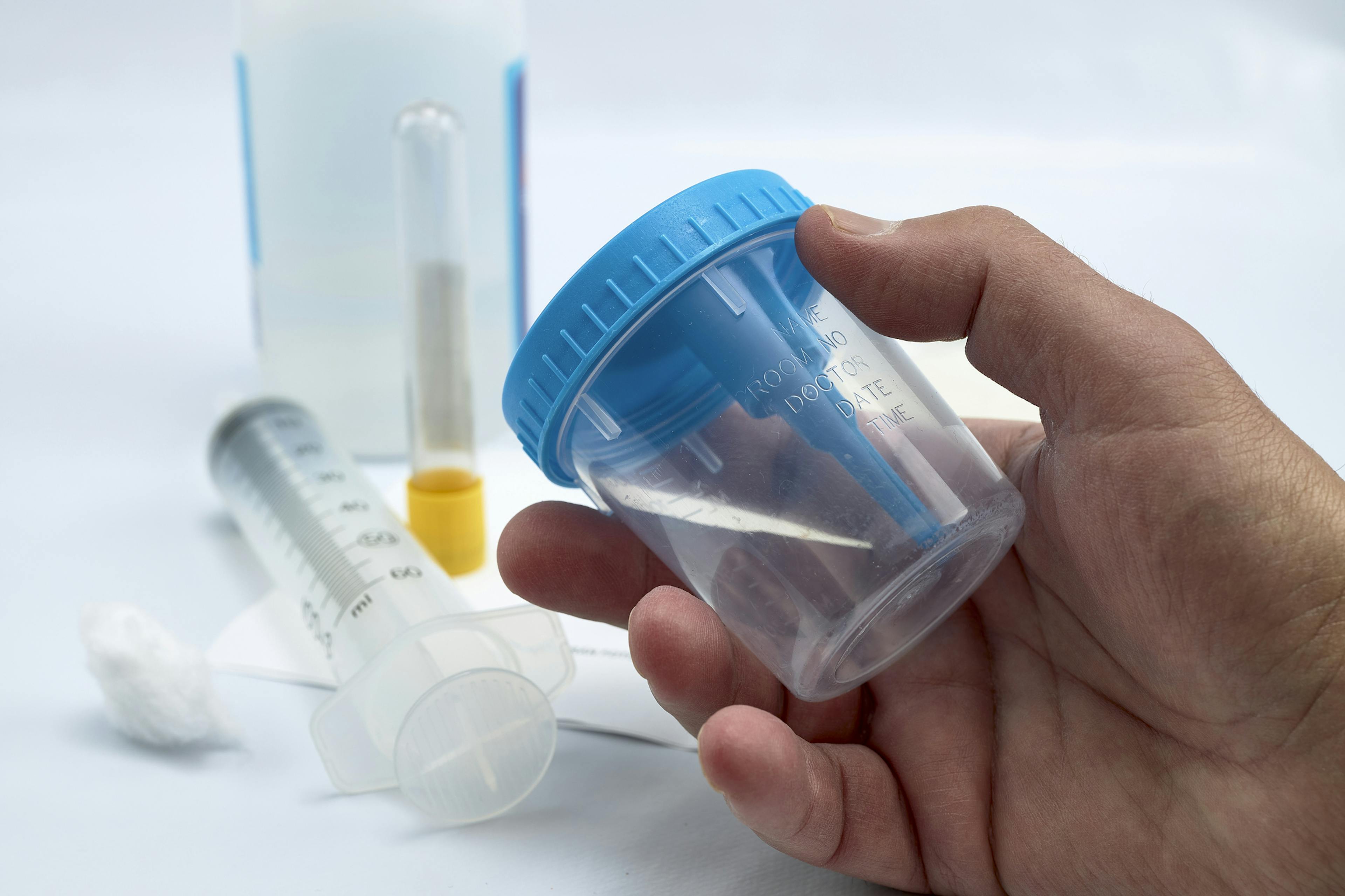 Contenant pour prélèvements de spécimen (urine et selles).