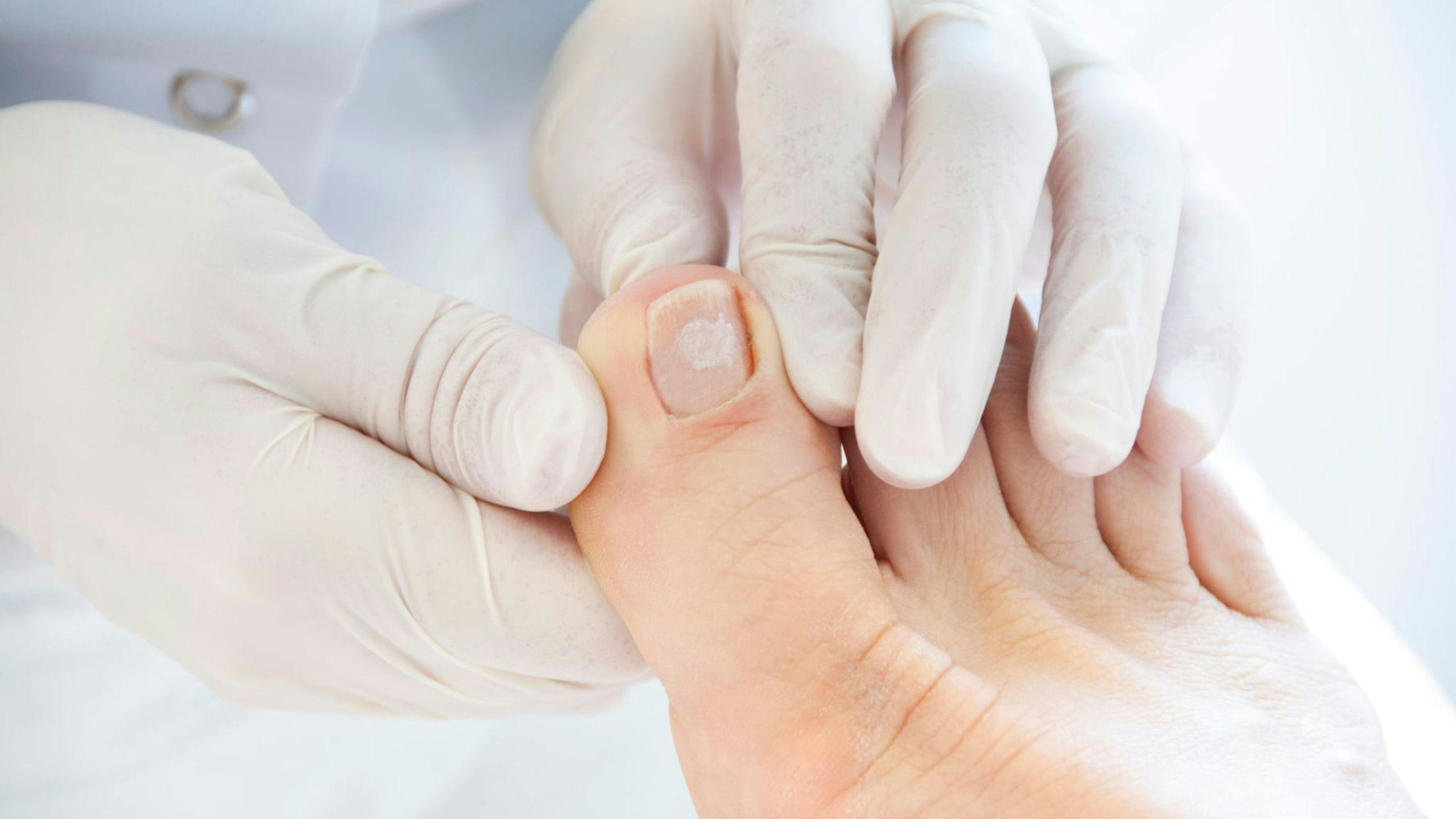 Infirmière en soins podologiques prodiguant des soins aux pieds d’une personne âgée, illustrant un emploi en santé préventive et bienveillante chez Aidexpress.