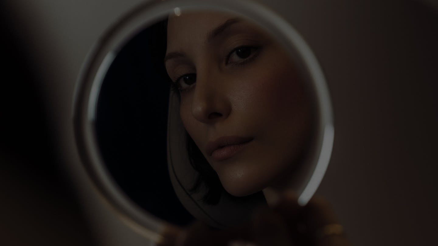 Suite et résultats Lifting du sourcil – Lifting temporal par le Dr. Alexandre Mertens