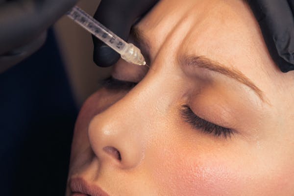 Les séances d'injections de botox