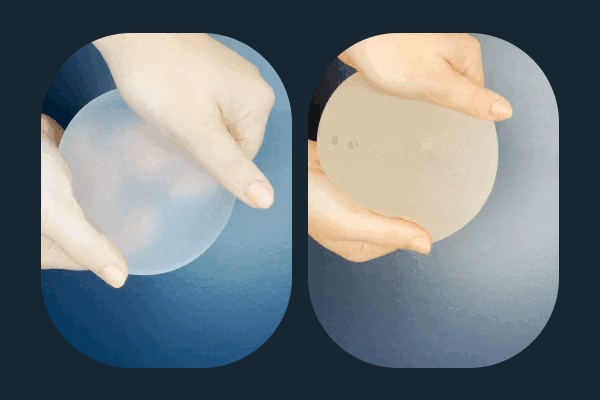 comparaison de 2 types d'implants mammaire