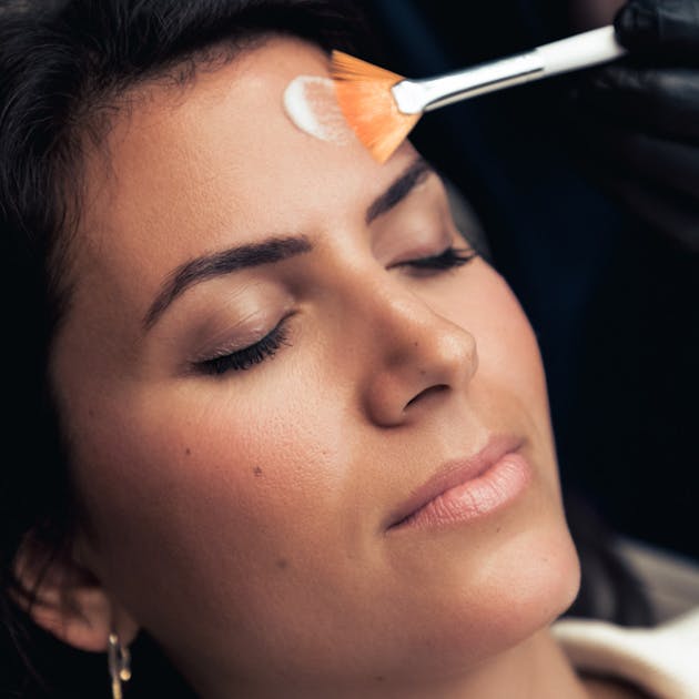 Les peelings à Lyon et Vienne par le Dr Mertens