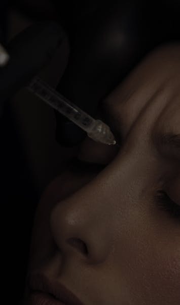 Injections de Toxine Botulique par le Dr. Alexandre Mertens