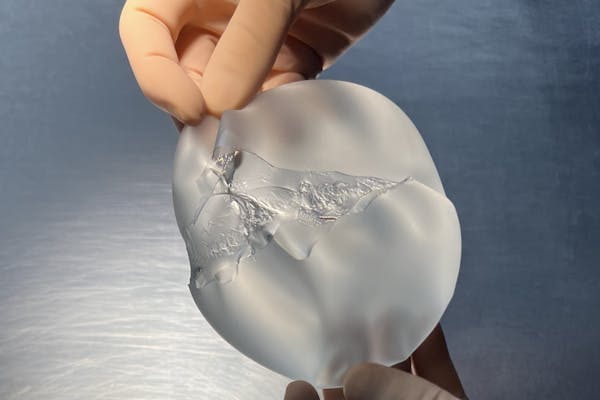 implant mammaire déchiré gel cohésif