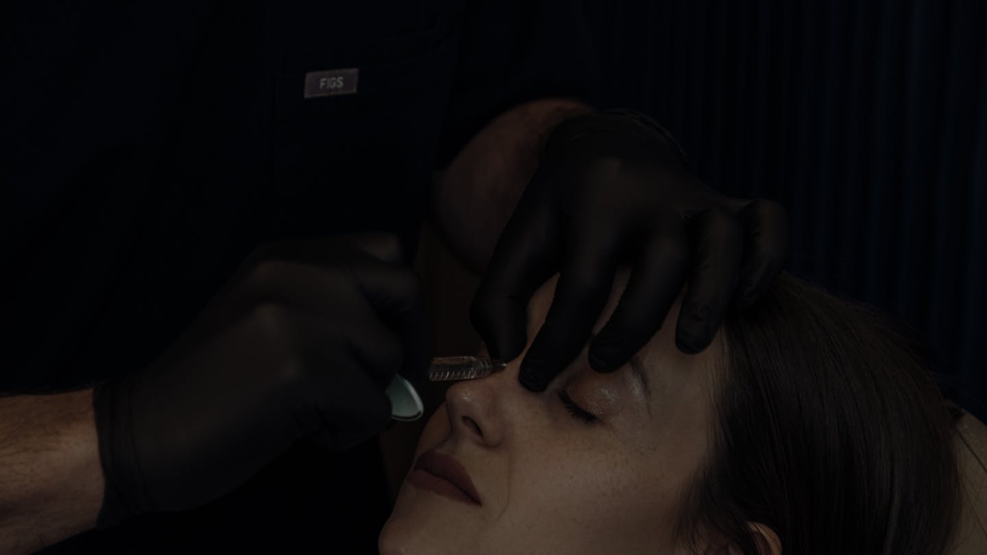 Séance d'injections d'acide hyaluronique pour une rhinoplastie médicale par le Dr. Alexandre Mertens