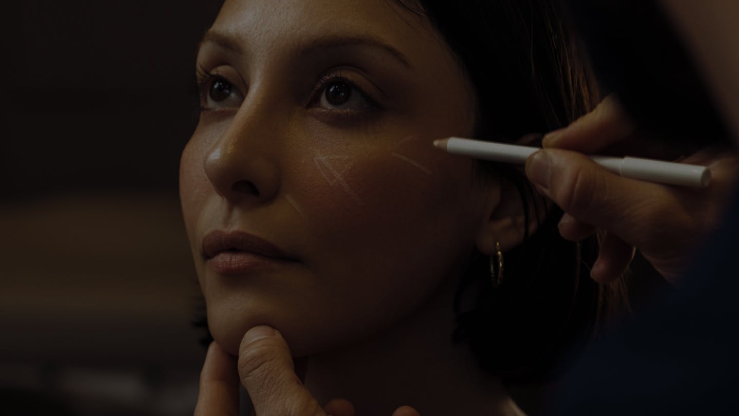 Chirurgie du visage par le Dr. Alexandre Mertens