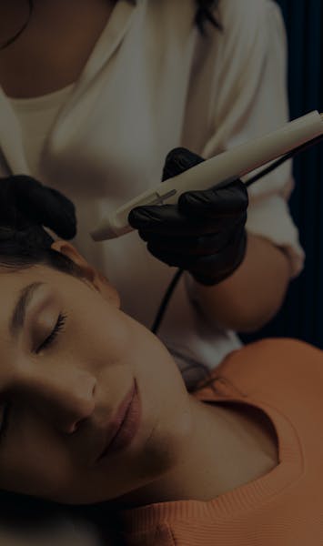 Radiofréquence microneedling