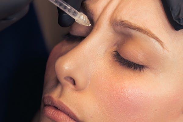 Visage Figé : Distinguer Botox et Lifting