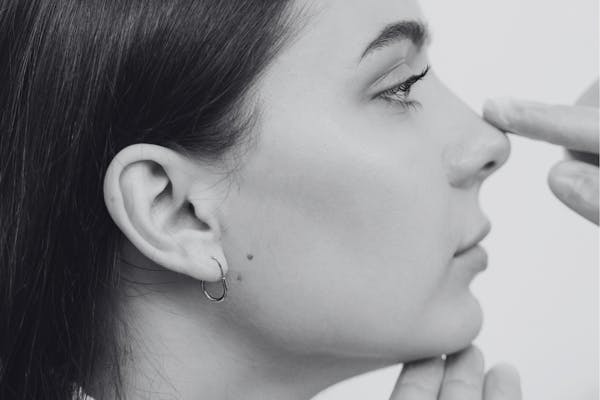 Jeune femme qui se fait analyser le nez par chirurgien pour une rhinoplastie.