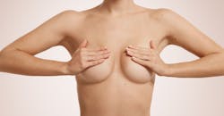 augmentation mammaire : effet faux seins