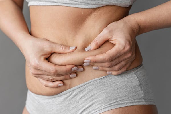 relâchement cutané femme