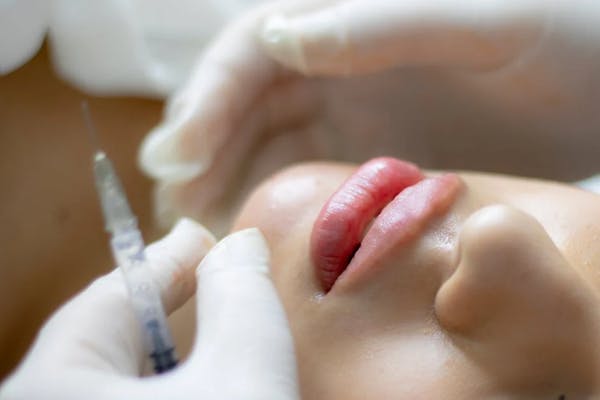 fake injectors | faux medecins esthétique