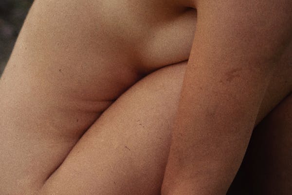 Partie du corps d'une femme pour illustrer les cicatrices qu'une femme est susceptible d'avoir après une réduction mammaire.