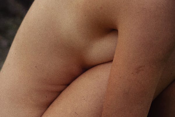 Maladie de Mondor après Chirurgie Mammaire