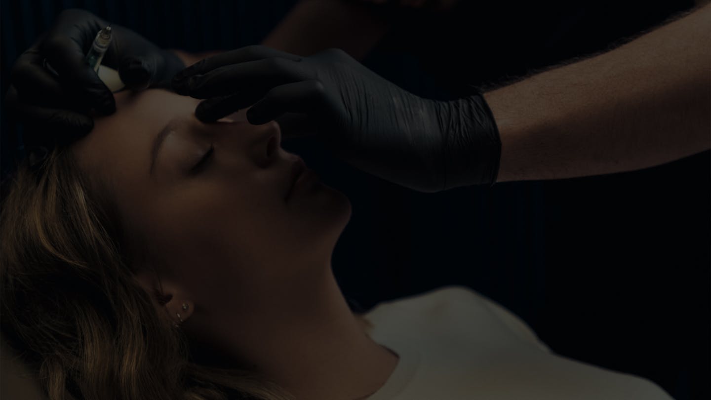 Rhinoplastie médicale par le Dr. Alexandre Mertens