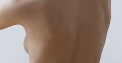 Seins naturels tubéreux