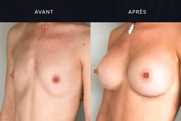 les malformations mammaires | Dr. Mertens