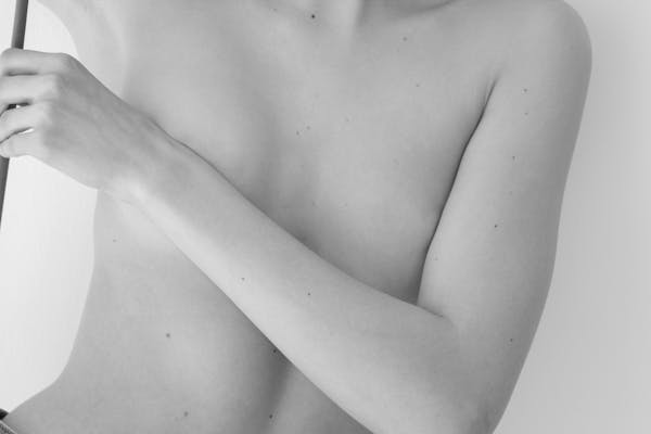 correction seins tubéreux | Dr Mertens Lyon