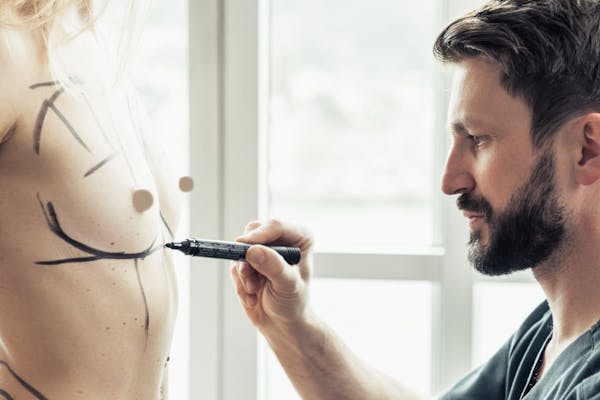 Augmentation mammaire par implants avec le Dr Mertens