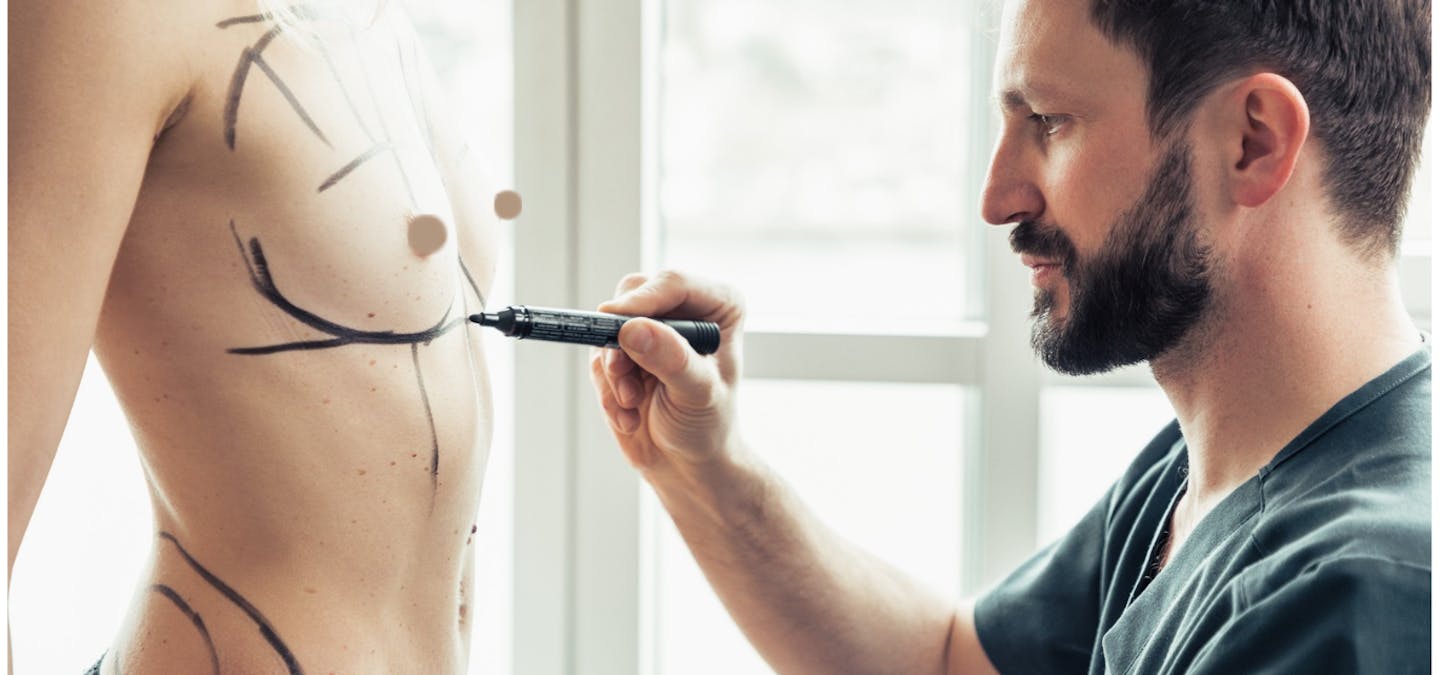 combiner lifting mammaire avec prothèse