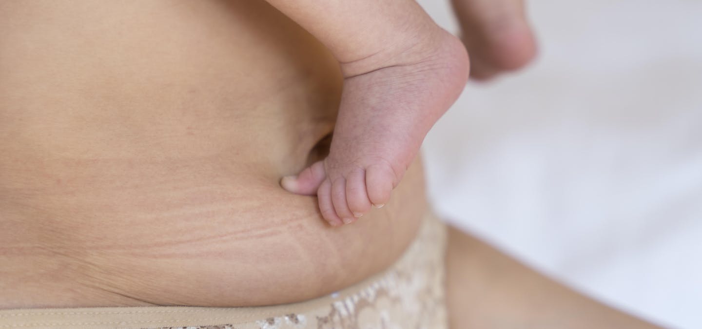 raffermir le ventre après grossesse