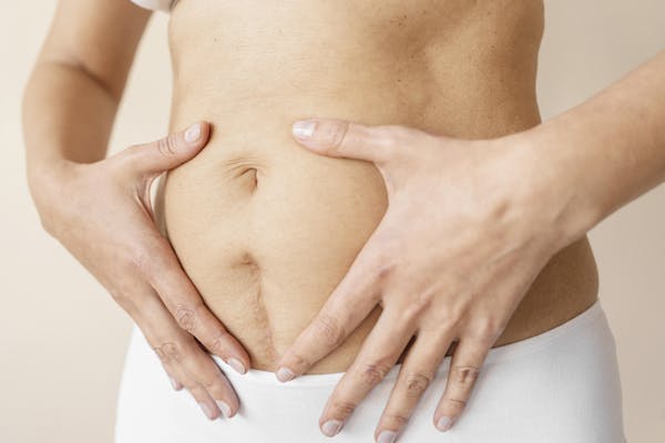 mommy makeover après grossesse