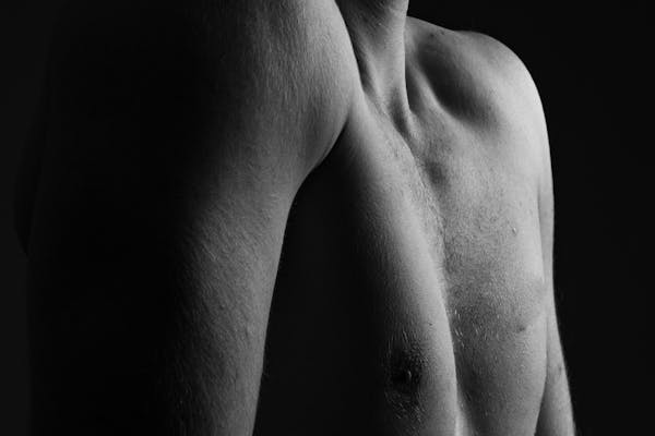 gynécomastie chez l'homme