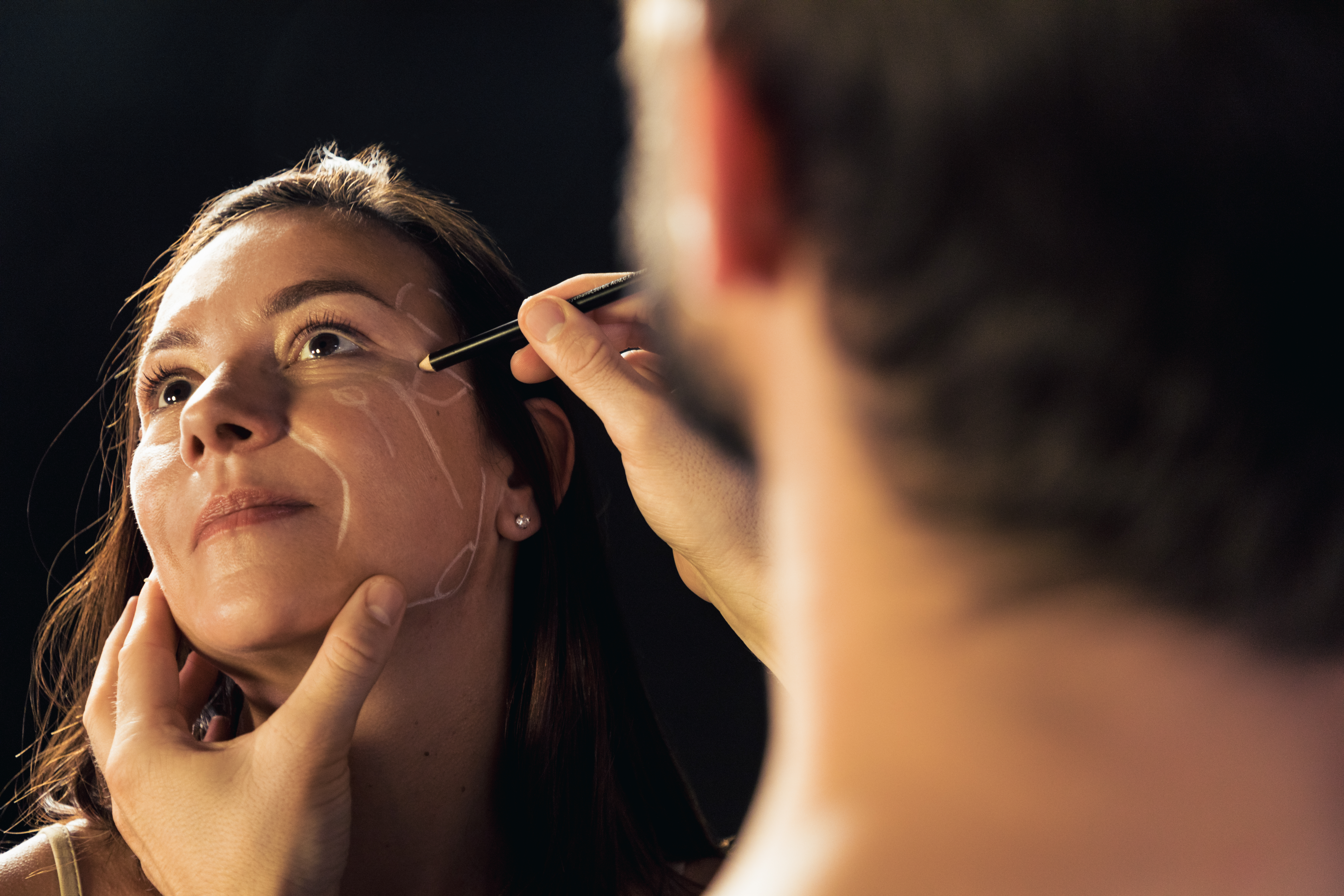 injection d'acide hyaluronique