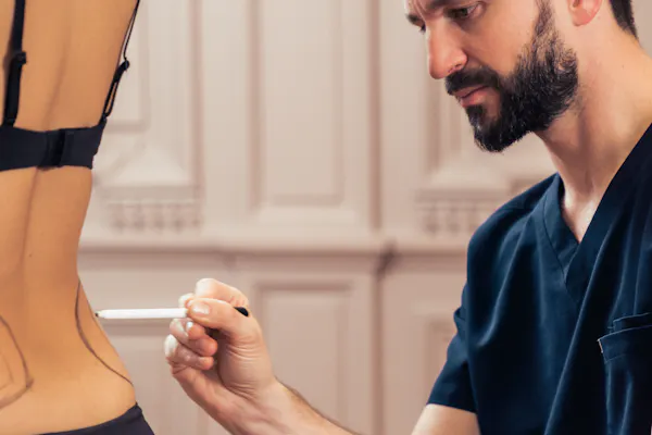 Des courbes plus féminines avec le Lipofilling fessier - Augmentation des fesses par transfert de graisse